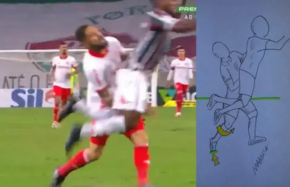 tempo de afastamento depois da lesão de LCA: Dr. Marcelo Corvino - Ortopedista - Os-seis-meses-e-o-ligamento-cruzado-anterior-do-joelho-Marcelo-Corvino-Brasilia